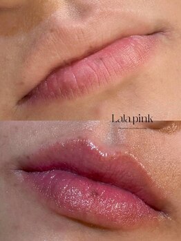 フレイヤビューティー スハダラボ 恵比寿(Freyia Beauty Suhada LABO)/-ララピンク-