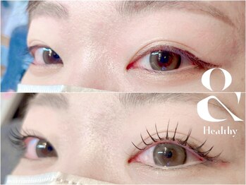 アフェプラス トータルビューティーサロン 香里園店(affe+ total beauty salon)/エクパ(アンドヘルシー)LED100本