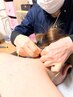【体の疲労を徹底改善】はり灸+マッサージ 90分 ¥9000