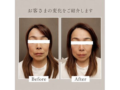 ソヨリプラス(Soyory Plus)の写真