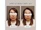 ソヨリプラス(Soyory Plus)の写真