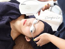 カルフール リル 草加駅西口店(Carrefour lir)/顔脱毛：全員3500円／都度払い