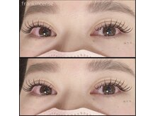 フランキンセンス 香取佐原店/付け放