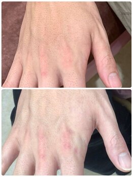 カシワビューティーココ(kashiwa beauty coco)/美肌脱毛