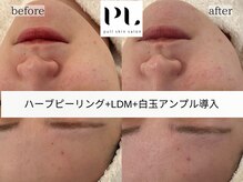 プルスキンサロン 大阪店(pull skin salon)/