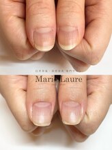 マリーロール 梅田店(Marie Laure)/深爪矯正/自爪育成/自爪風