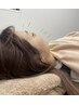 【小顔・美肌効果◎即効性抜群☆】美容鍼
