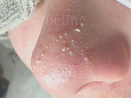 ベルネ(bellne)の写真