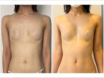 スカイ(sky)/美バスト＆美姿勢