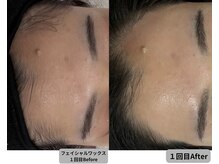 ミシル(Mishil)/パールワックス初回