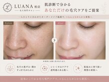 ルアナ 柏店(LUANA)の雰囲気（毛穴の黒ずみ・開き・シミ・くすみをケア）