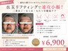 【速攻小顔★水玉リフティング】むくみ撃退！フェイスラインすっきり￥13800→