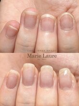 マリーロール 淀屋橋本店(Marie Laure)/自爪育成/深爪矯正/ネイルケア