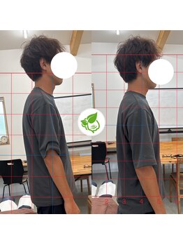 カイロプラクティック ネクサス/猫背と巻き肩を撃退☆