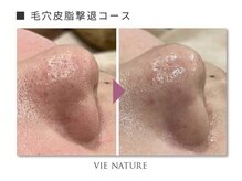 ヴィナチュール(vie nature)/ ■毛穴ケア