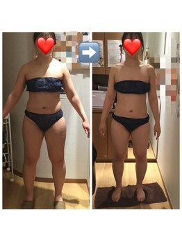 パルティール 銀座店 partir/劇的！サイズダウン効果【銀座】