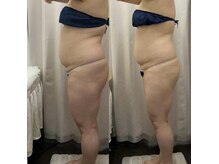 ベルミーランド MEGAドン・キホーテ草加の雰囲気（痩身BeforeAfter）