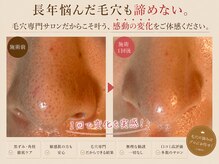グレイスヒーリング(GRACE HEALING)の雰囲気（1度でここまでの効果を引き出す施術をします）