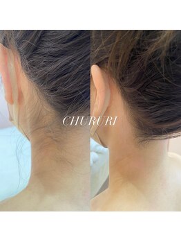 チュルリ 天満橋店(Chururi)/大人気の【うなじワックス脱毛】