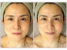 アン グレーヌ 自由が丘(unegraine)/まぶたスッキリ！笑顔も溢れます