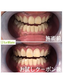 ルブラン 奈良店(Le Blanc)/今すぐ予約もOK！