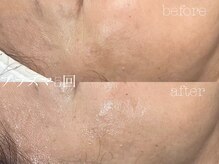 ロイ 初生店(LOI)/プラズマ×韓国リジュラン