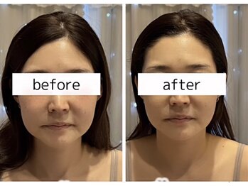 ビューティーサロン リリー(Lily)/