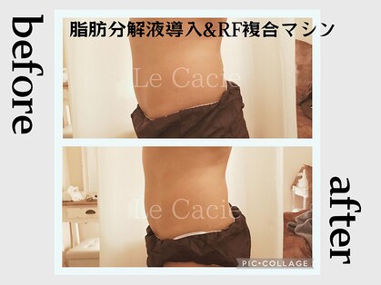 ルカシエ(Le Cacie)の写真
