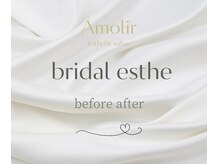 アモリール(Amolir)/ブライダルエステ