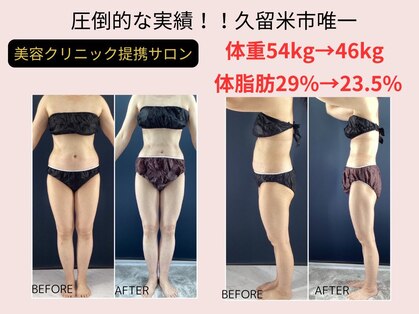ルビー(RUBY)の写真