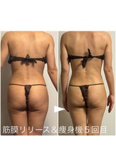 太陽と月/筋膜リリース+アロマオイル5回目