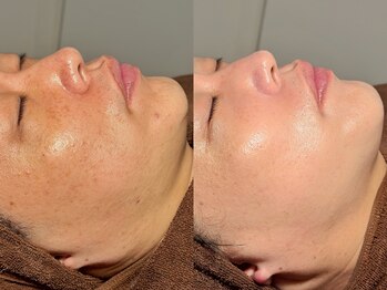 ルーナジェーナ(Luna llena)/