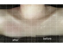 トニック バイ まつもと整骨院鍼灸院(Tonic)/★Before After★豊中／リンパ