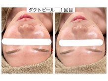 エメリア(Emelia)/