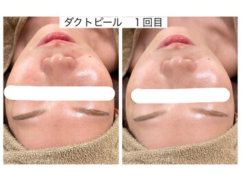 エメリア(Emelia)/