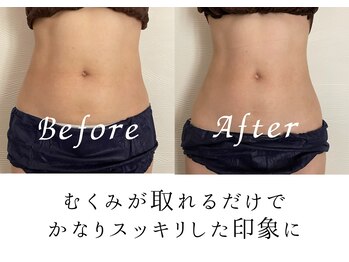 セルフィット鍼灸整骨院/恵比寿インディバボディ