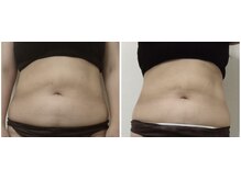 エタンセル(Etincelle)