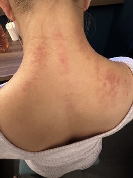 ビューティーサロンエイト(Beauty Salon8)/結果重視の効果実感♪