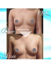 PMK ルグラン 品川店(PMK Le Grand)/バストUPケア20回施術