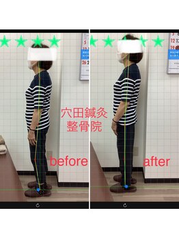 穴田鍼灸整骨院/整体・骨盤・ねこぜ・まき肩矯正