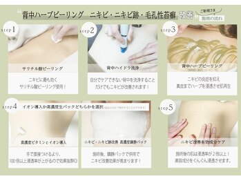 ビズビズ 天王寺店(bisebise)/背中ハーブ×背中ハイドラ洗浄