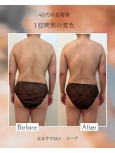 リープ(lieb)/お客様before→after