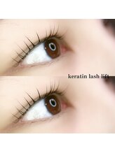 フォーヴリュンヌ(FOVLUNE)/ラッシュリフト