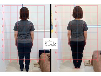 叶'エル 本町 心斎橋院/O脚改善　美脚矯正