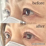 アールアイ(R-i)