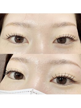 イヴ(Eve)/施術担当 CHIHIRO