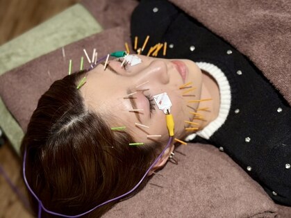 菫鍼灸院の写真