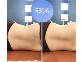 リシア(RECIA)/お腹の痩身