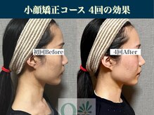 キュープ 表参道店(Qpu)/継続が「小顔」と「美」をつくる