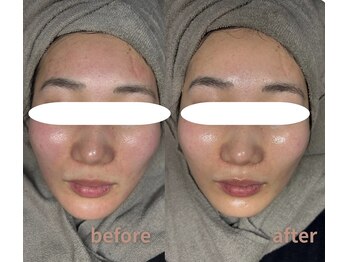 マリーメリー(marie merry)/艶肌wax+プラズマシャワー